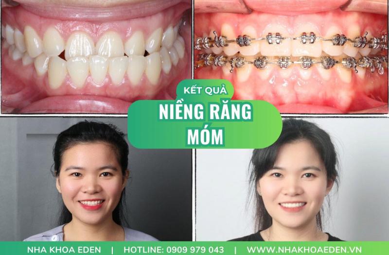 Nha Khoa Eden - International Dental Clinic