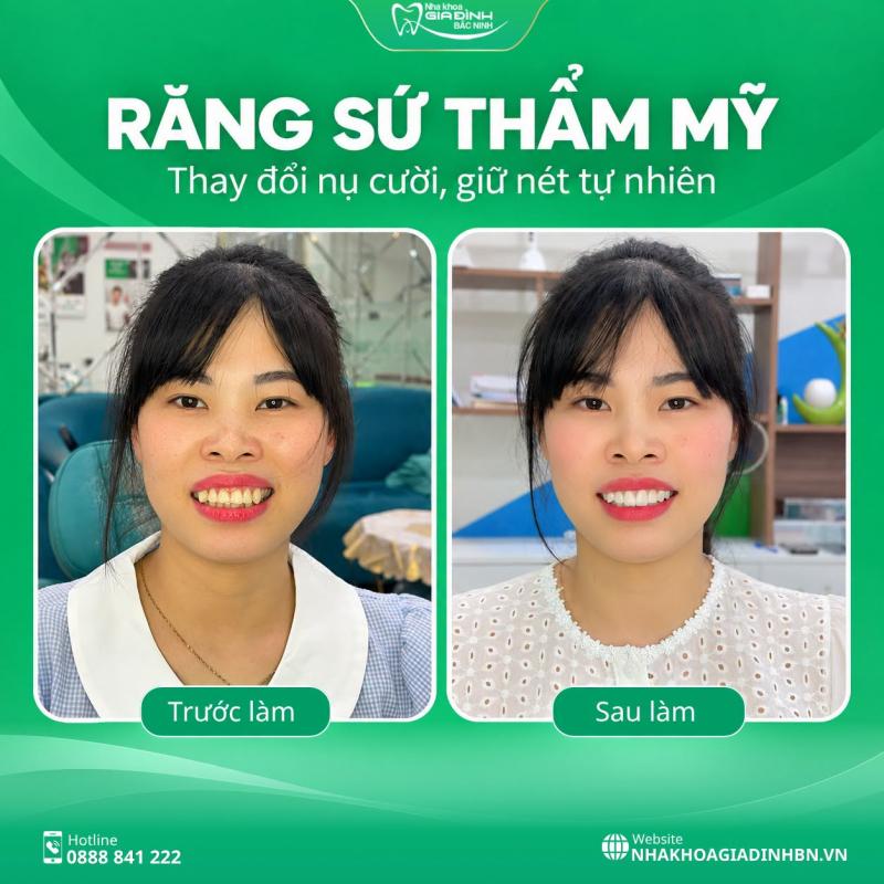 Nha Khoa Gia Đình Bắc Ninh