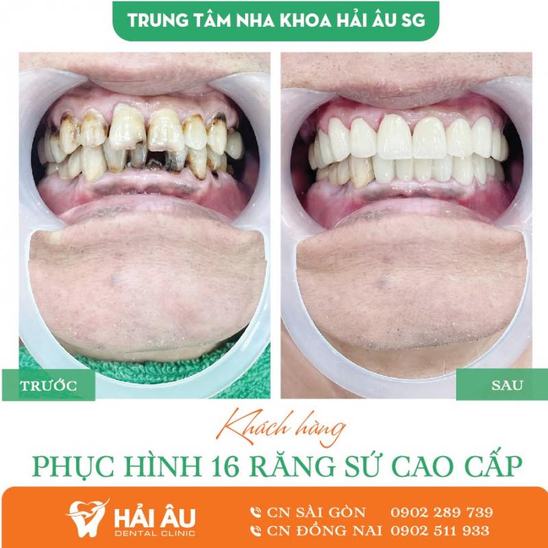 Nha khoa Hải Âu