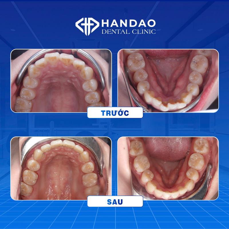 Ảnh minh hoạNha khoa Hân Đào