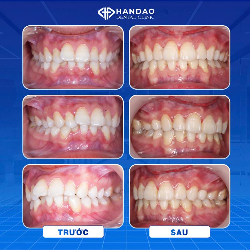 Nha Khoa Hân Đào Thái Bình