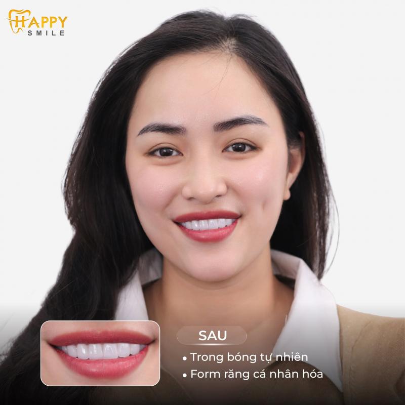 Nha khoa Happy Smile