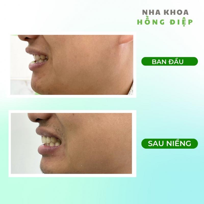 Nha Khoa Hồng Điệp