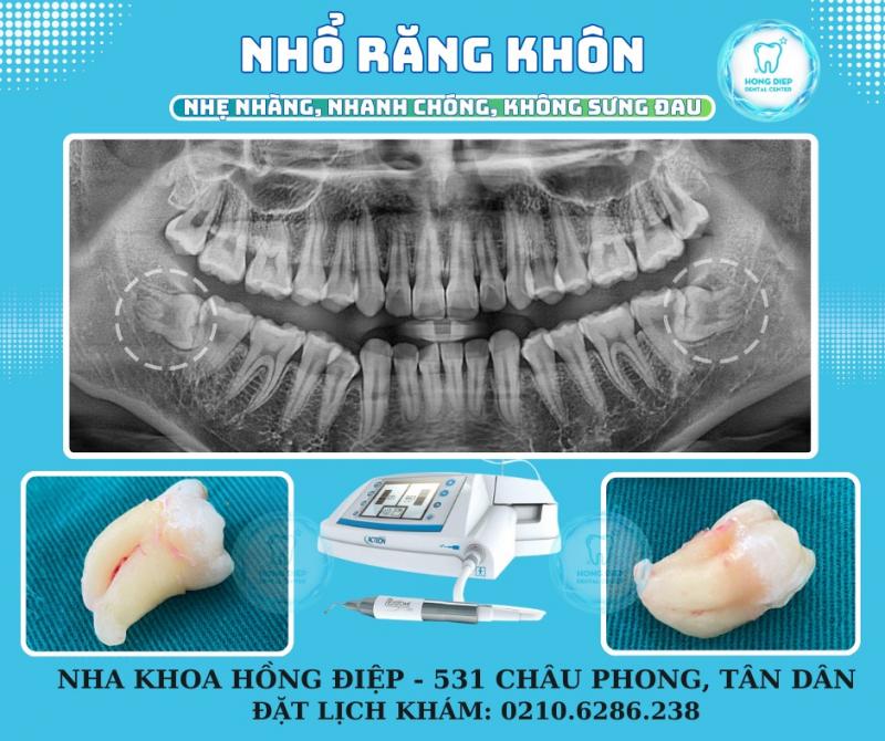 Nha khoa Hồng Điệp