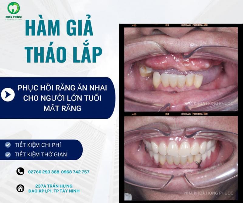 Nha Khoa Hồng Phước