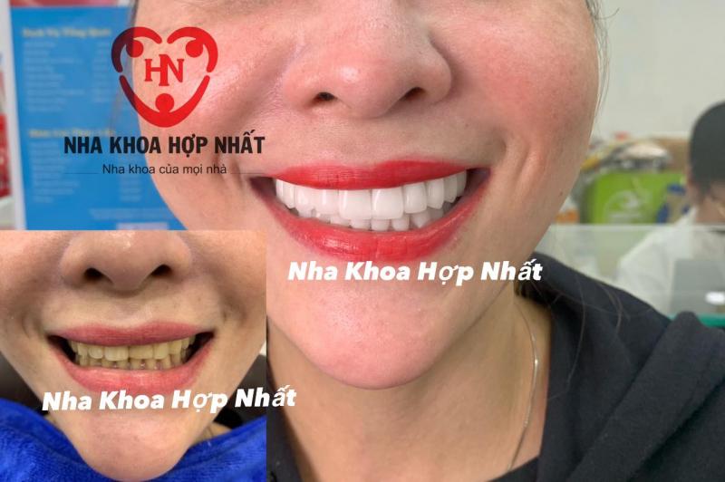 Nha khoa Hợp Nhất