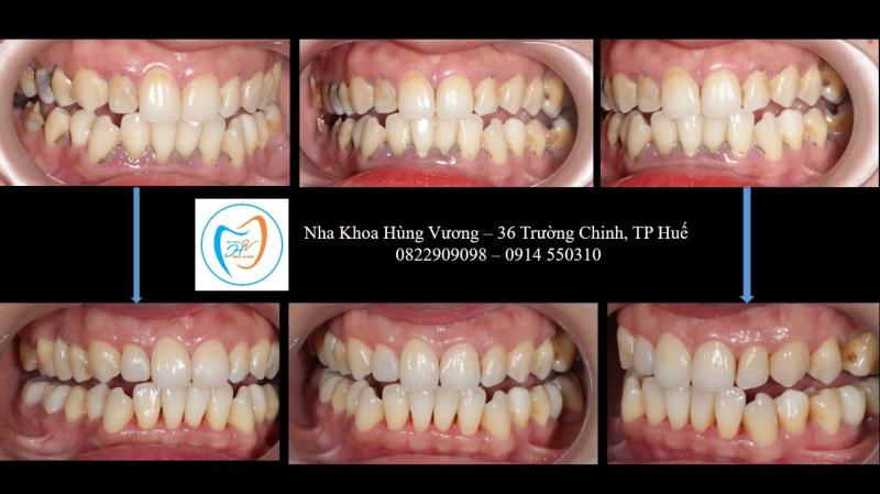 Nha khoa Hùng Vương