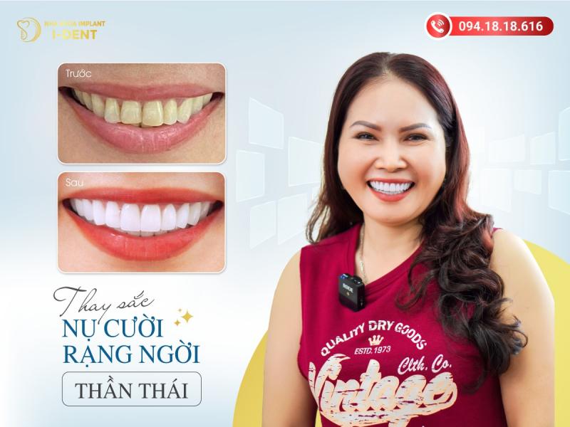 Nha Khoa I-Dent