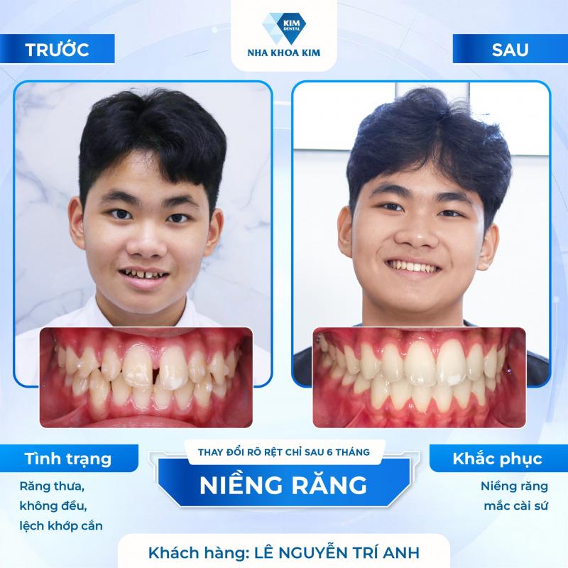 Nha Khoa Kim