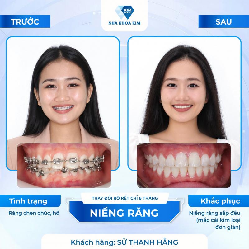Nha Khoa Kim