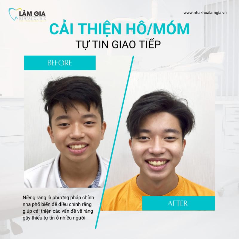 Nha Khoa Lâm Gia