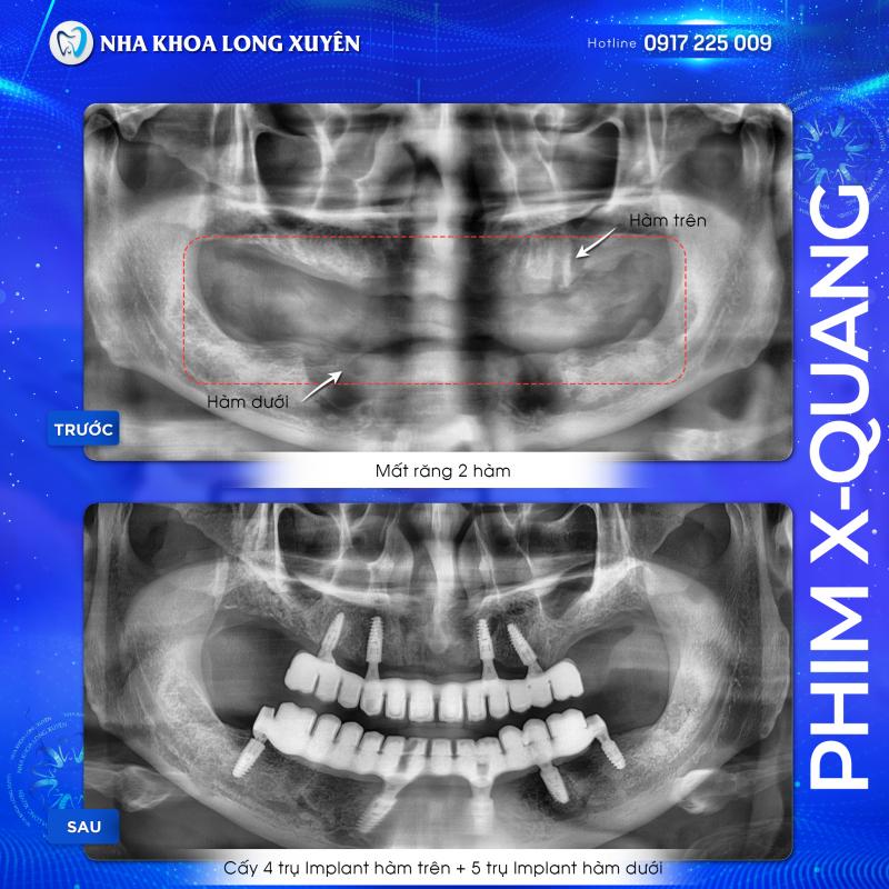 Nha Khoa Long Xuyên