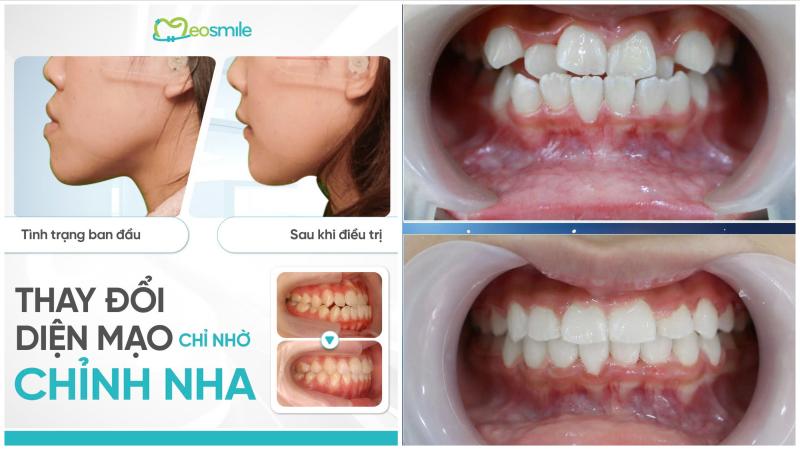 Nha Khoa Neosmile