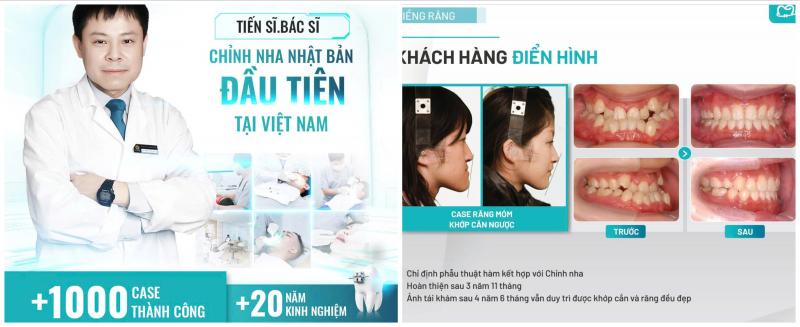 TS.BS.Nguyễn Anh Tuấn- Tiến sĩ chỉnh nha Nhật bản - Nha khoa NeoSmile