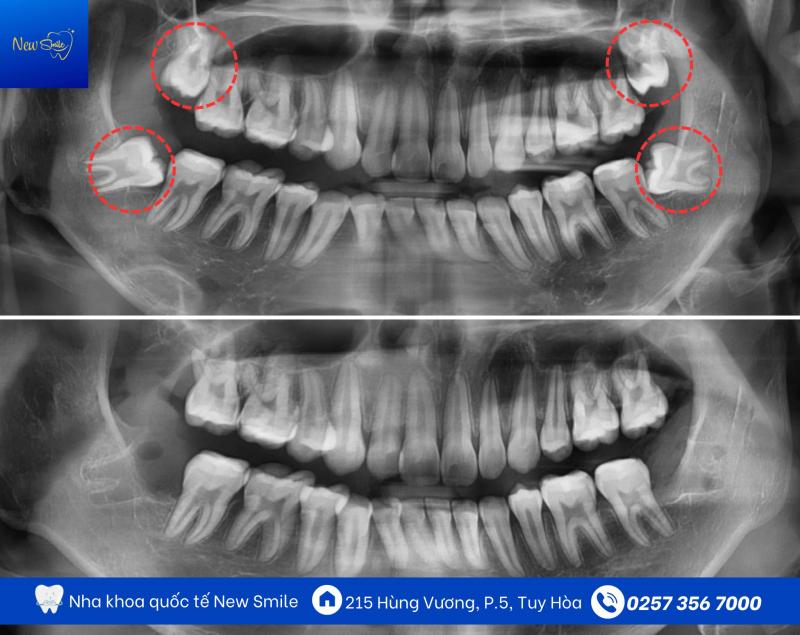 Nha Khoa New Smile