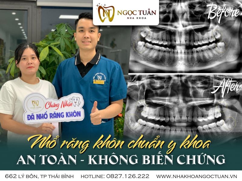 Nha Khoa Ngọc Tuấn