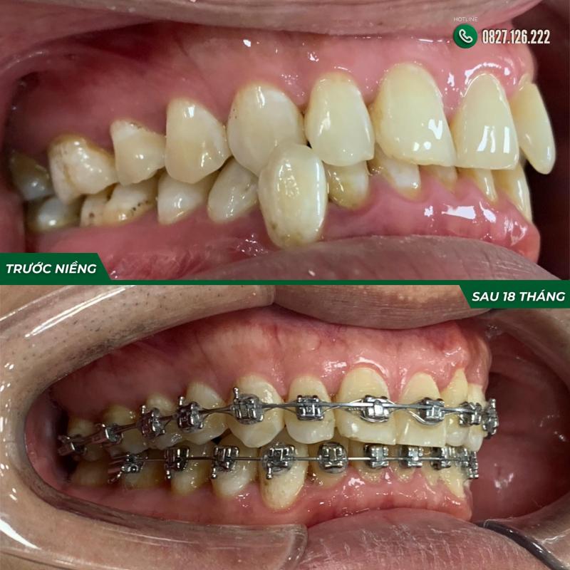 Nha khoa Ngọc Tuấn