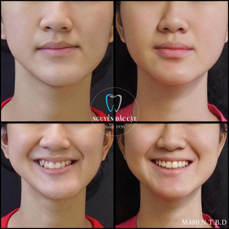 Nha khoa Nguyễn Đắc Cật