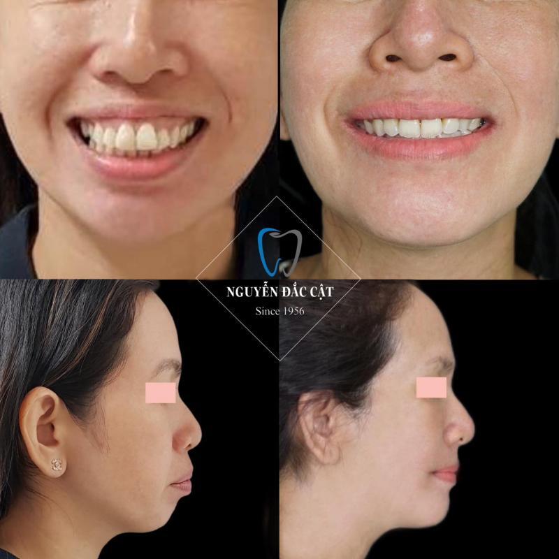 Nha khoa Nguyễn Đắc Cật