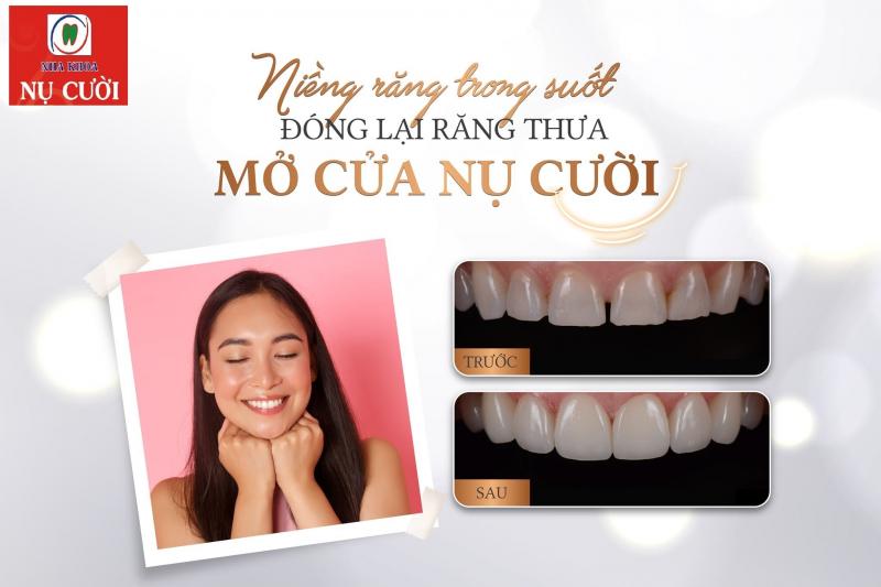 Nha Khoa Nụ Cười