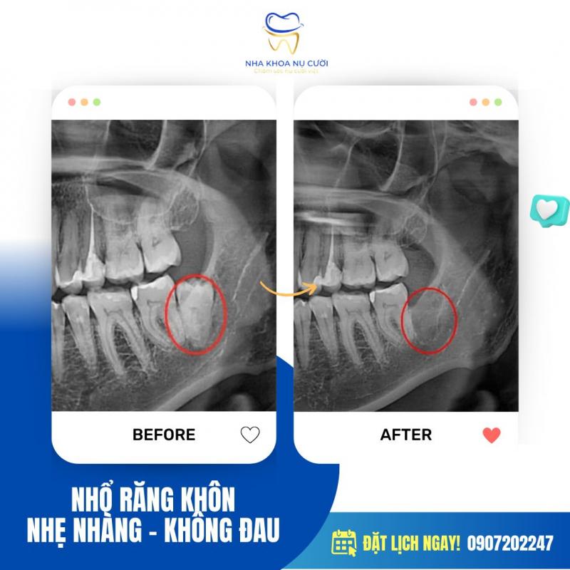 Nha Khoa Nụ Cười Đà Lạt