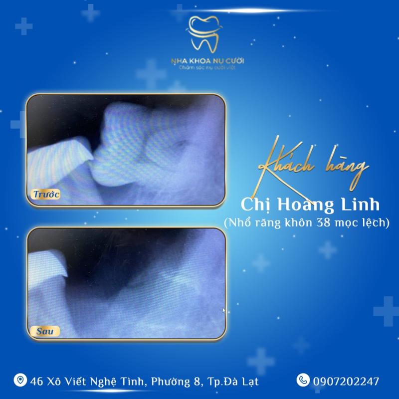 Nha Khoa Nụ Cười Đà Lạt