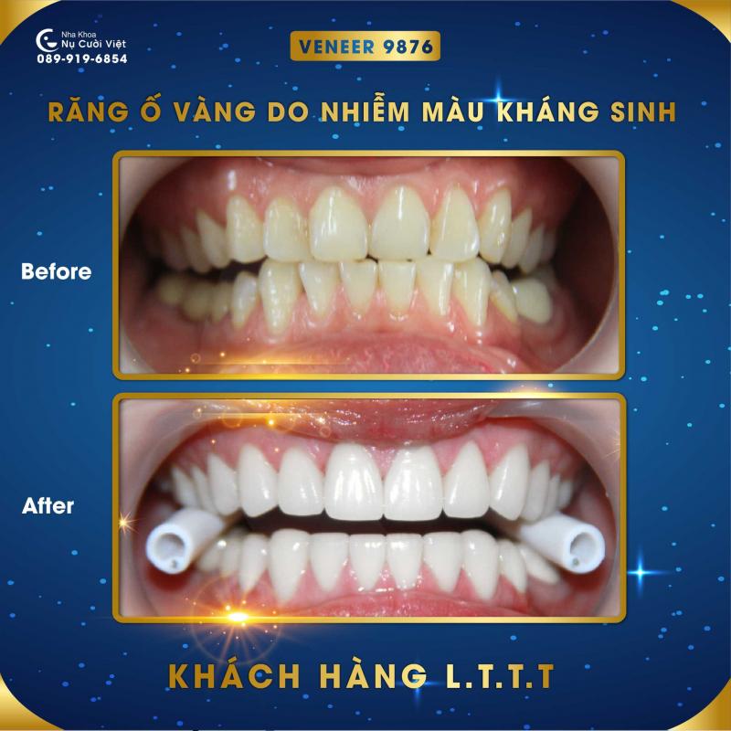 Nha khoa Nụ Cười Việt