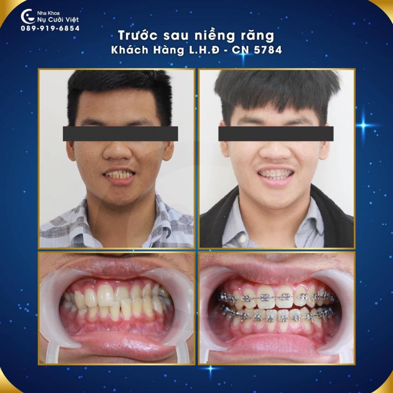 Nha khoa Nụ cười Việt