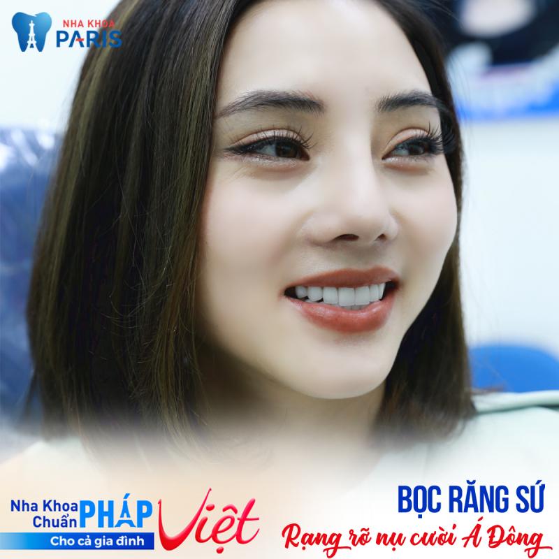 Bọc răng sứ tại nha khoa Paris