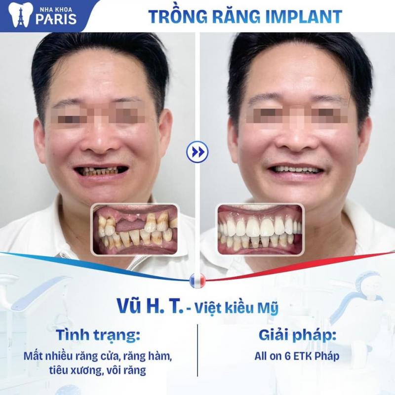 Nha Khoa Paris