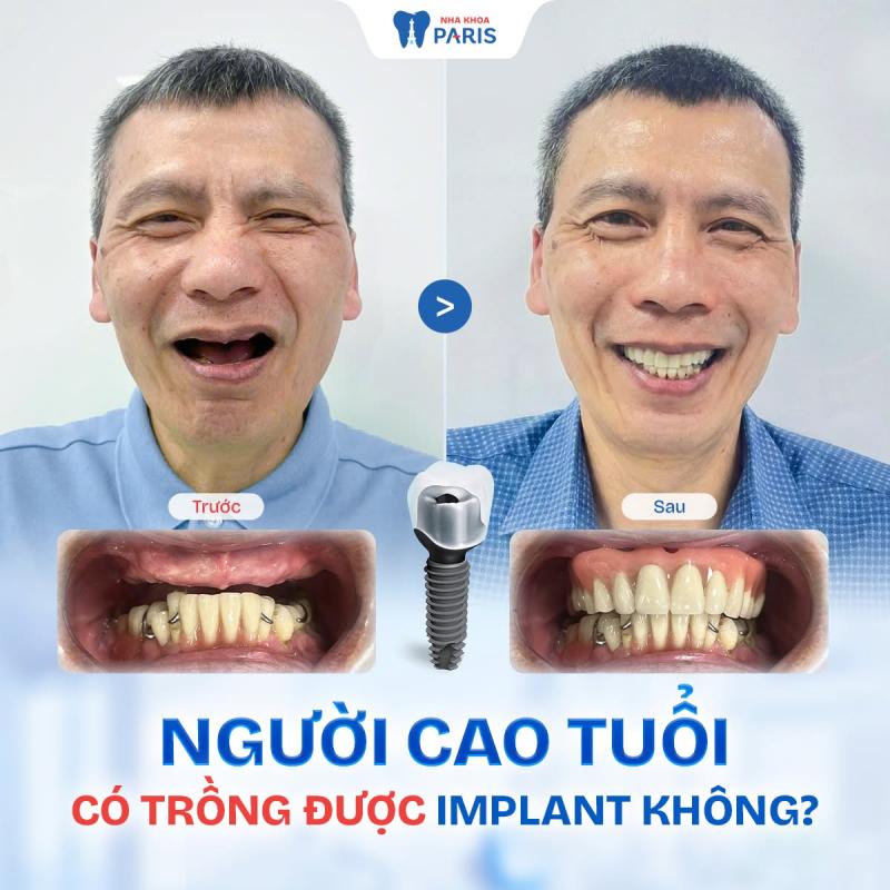 Nha khoa Paris