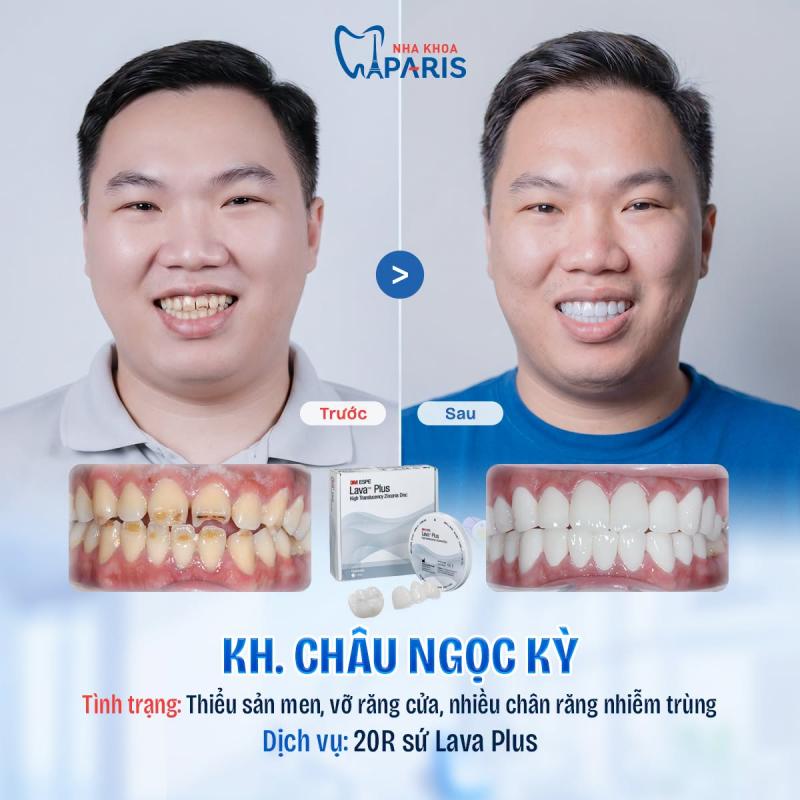 Nha khoa Paris