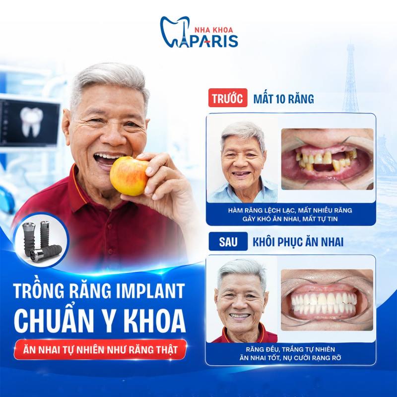Nha khoa Paris Đà Nẵng