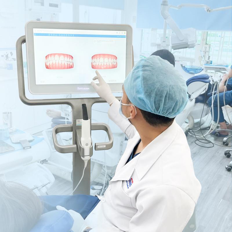 Bọc răng sứ tại nha khoa Paris