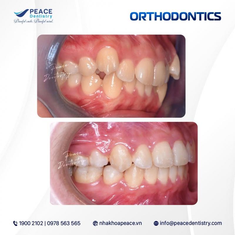 Nha Khoa Peace Dentistry