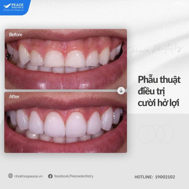 Nha khoa Peace Dentistry