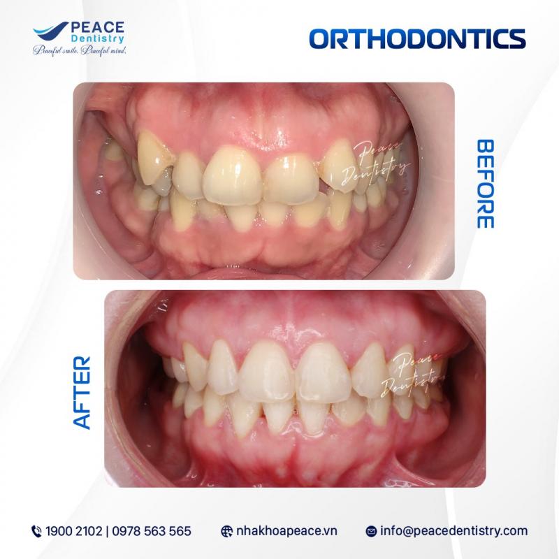 Nha Khoa Peace Dentistry Quận 7