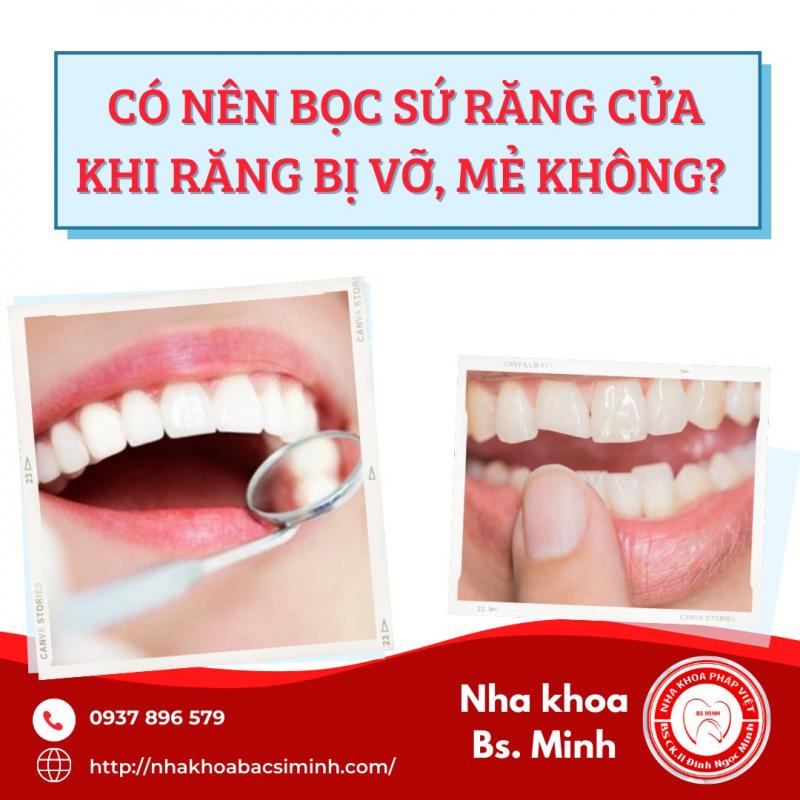 Nha khoa Pháp Việt được sự tin tưởng và lựa chọn của rất nhiều khách hàng trong và ngoài khu vực