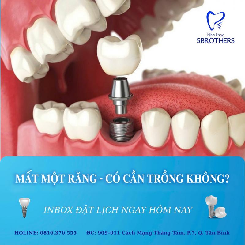 Nha Khoa Quốc Tế 5Brothers