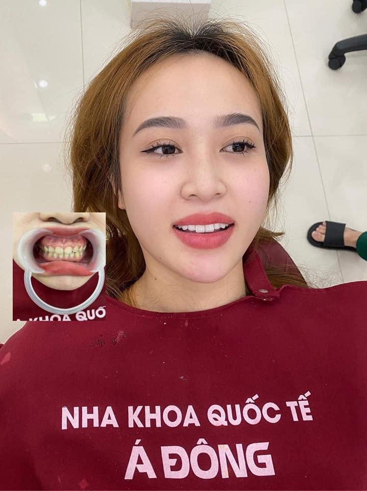 Nha Khoa Quốc Tế Á Đông