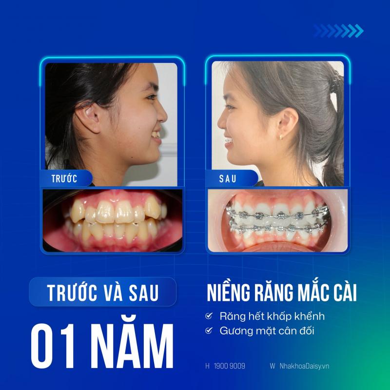 Nha khoa Quốc tế DAISY