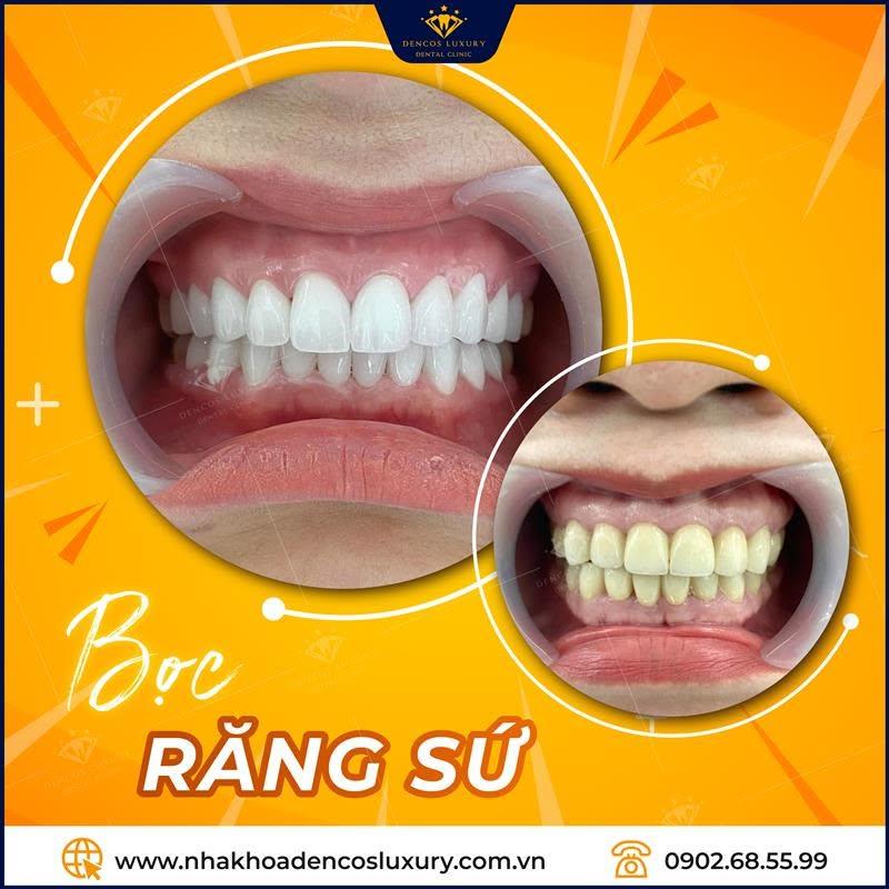 Nha Khoa Quốc Tế Dencos Luxury