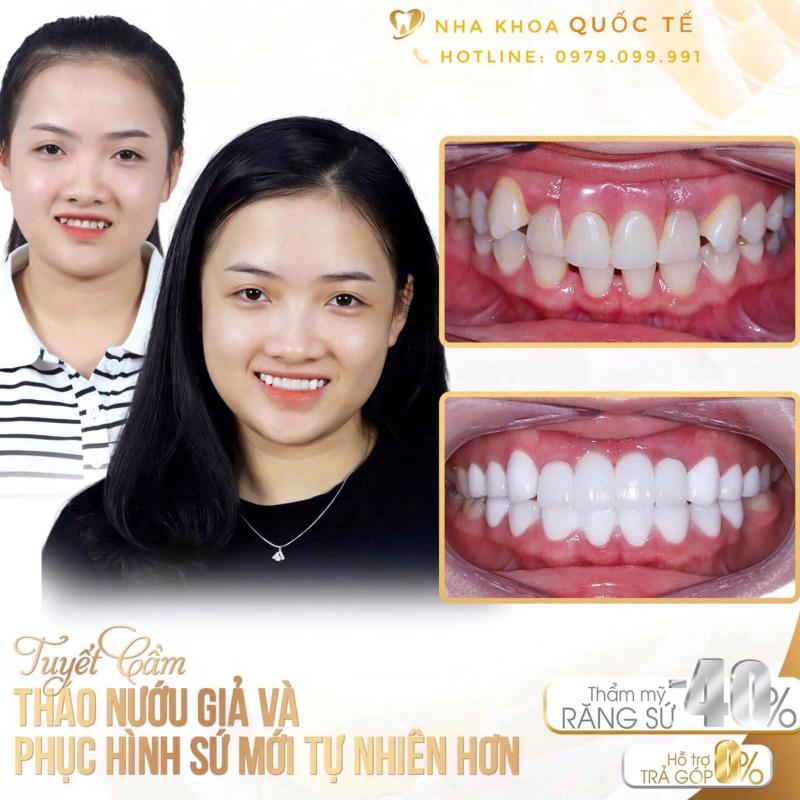 Nha Khoa Quốc Tế Rạch Giá