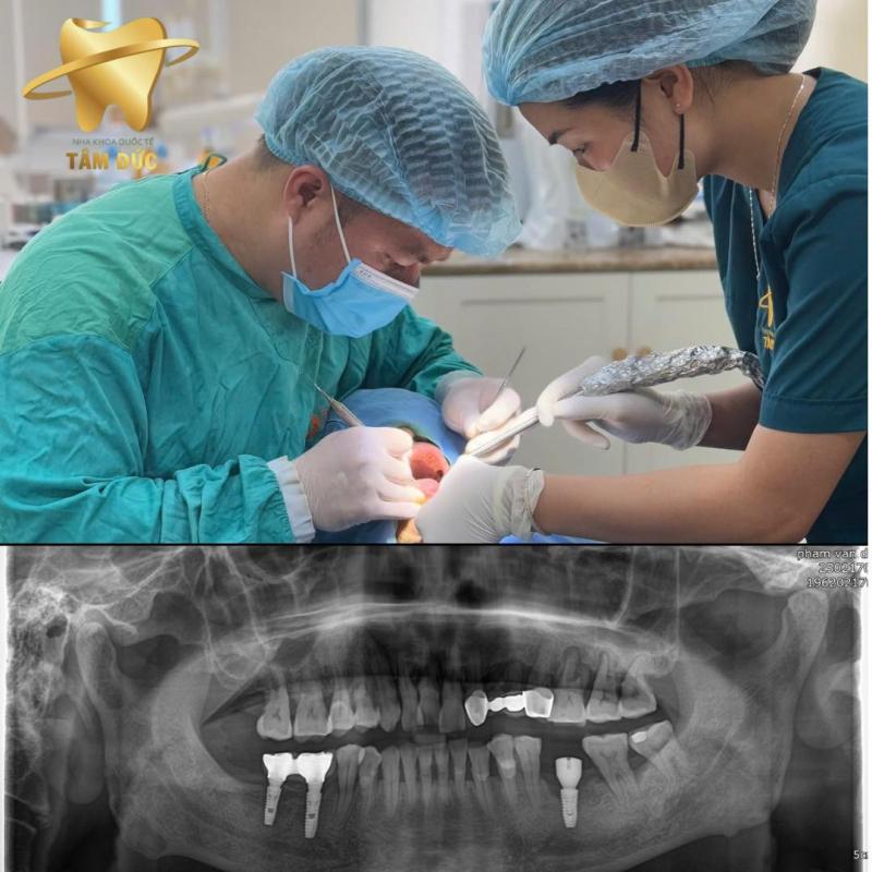 Nha Khoa Quốc Tế Tâm Đức