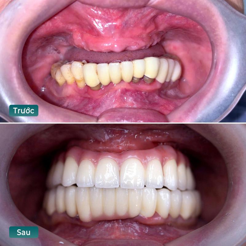 Nha khoa Quốc tế Việt Đức