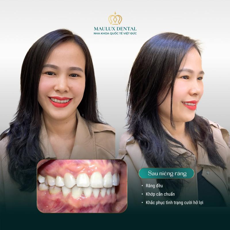 Nha khoa Quốc tế Việt Đức