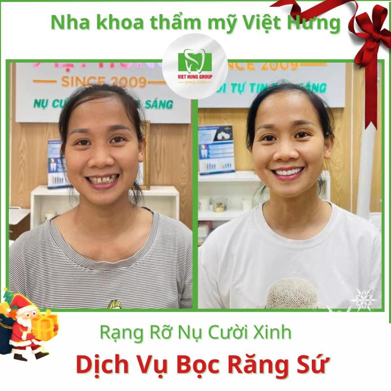 Nha khoa Quốc tế Việt Hưng