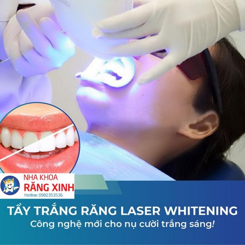 Kết quả tẩy trắng tại Nha khoa Răng Xinh