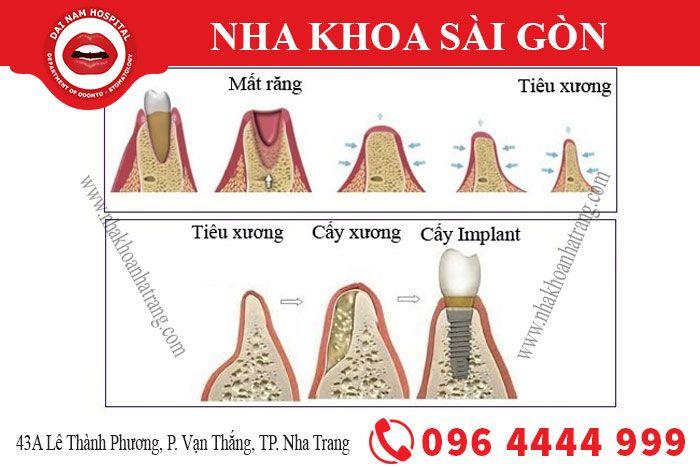 Nha Khoa Sài Gòn