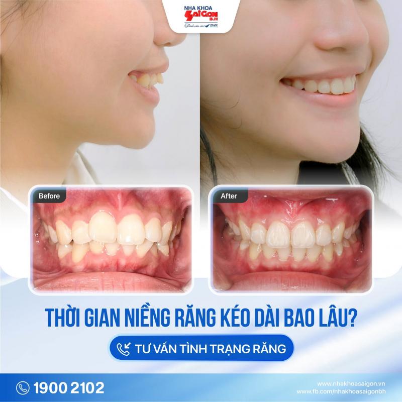 Nha Khoa Sài Gòn B.H
